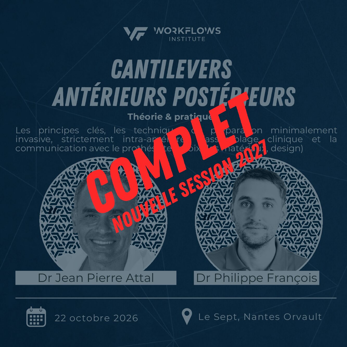 Cantilevers Antérieurs Postérieurs