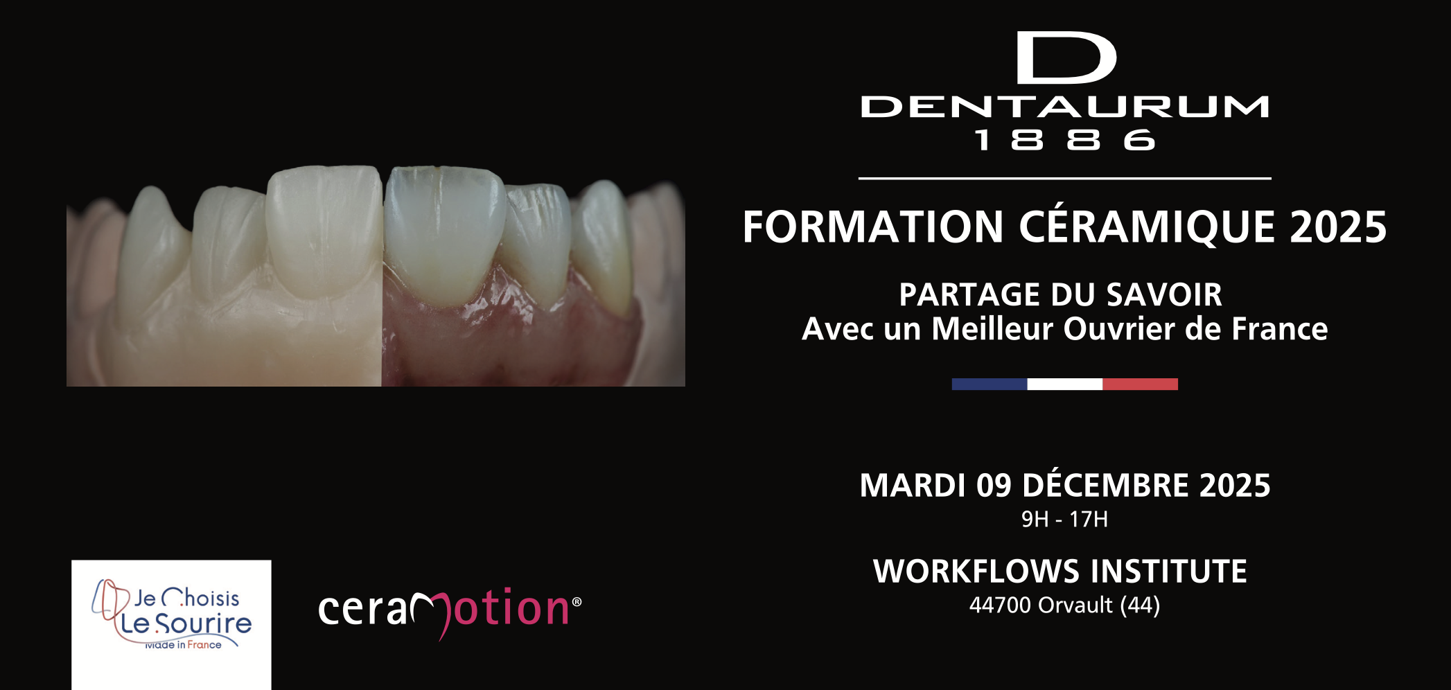 FORMATION CÉRAMIQUE DENTAURUM FORMATION CÉRAMIQUE DENTAURUM AVEC SEBASTIEN MILIASSEAU