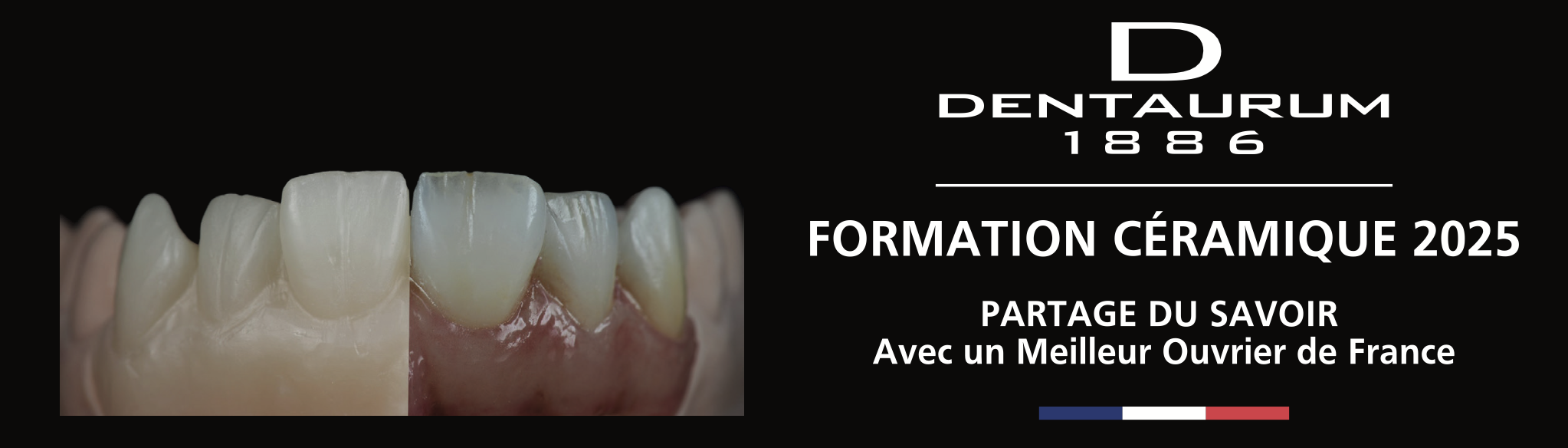 FORMATION CÉRAMIQUE DENTAURUM AVEC SEBASTIEN MILIASSEAU FORMATION CÉRAMIQUE DENTAURUM AVEC SEBASTIEN MILIASSEAU