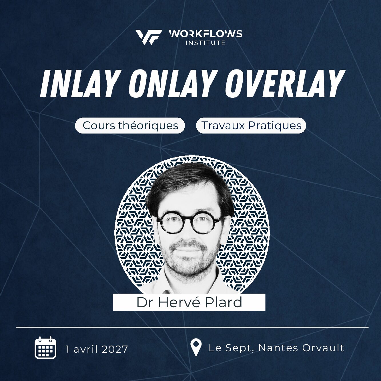 Inlay Onlay Overlay